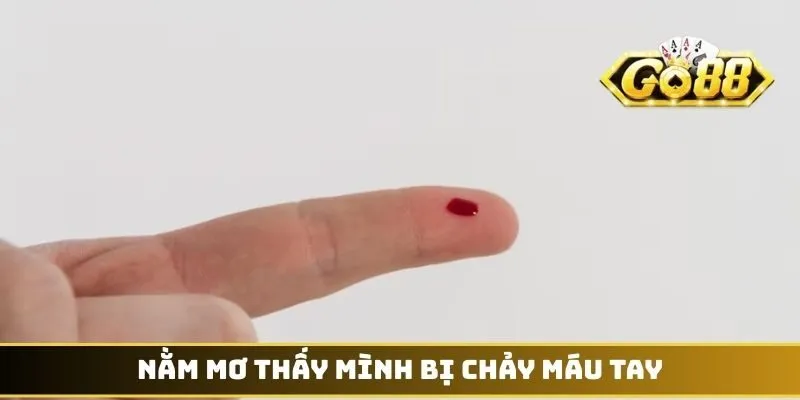 Nằm mơ thấy mình bị chảy máu tay